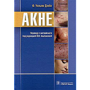 Akne