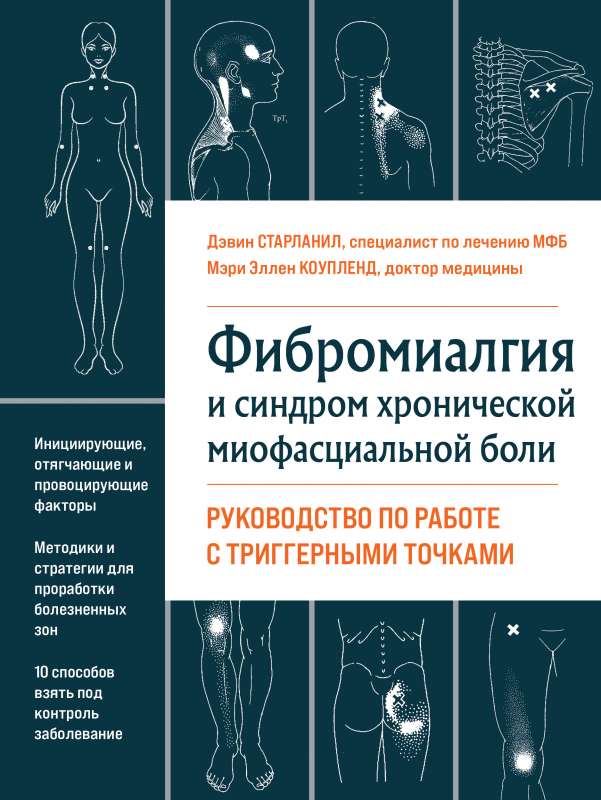 Fibromialģija un hroniskā miofasciālā sāpju sindroms. Rokasgrāmata darbam ar trigerpunktiem