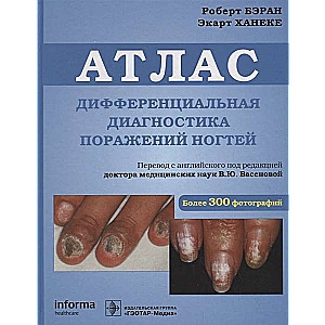 Atlants. Diferenciālā diagnostika nagu bojājumiem