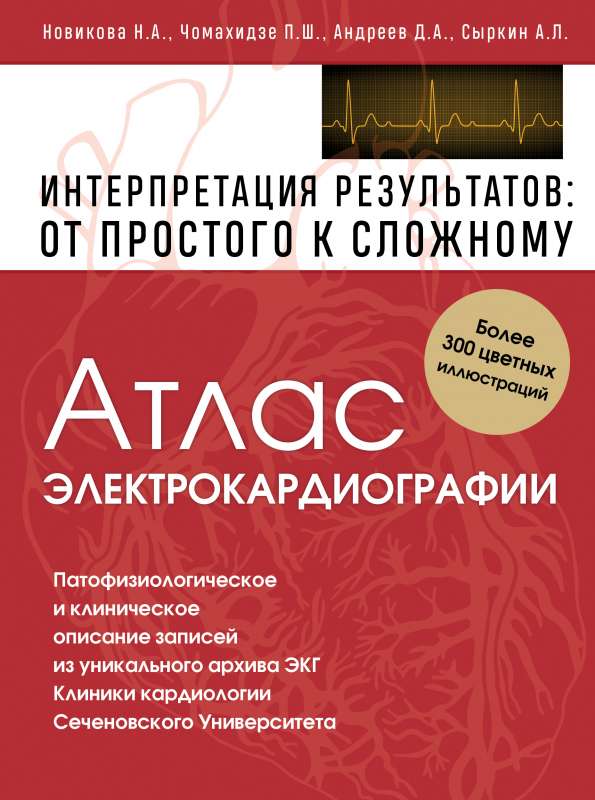Elektrokardiogrāfijas atlants. Rezultātu interpretācija: no vienkārša uz sarežģītu