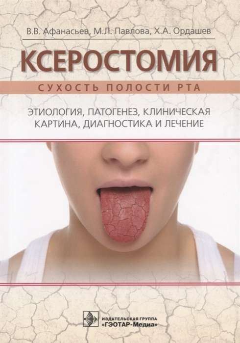 Ксеростомия. Сухость полости рта. Этиология, патогенез, клиническая картина, диагностика и лечение