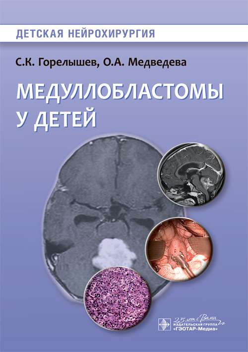 Medulloblastomas bērniem