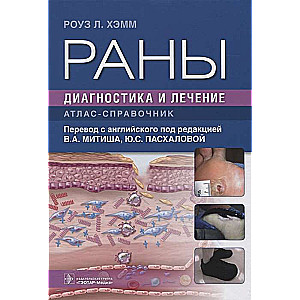 Brūces. Diagnostika un ārstēšana. Atlants-rokasgrāmata