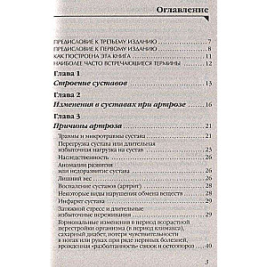 Artroze. Atbrīvojamies no sāpēm locītavās