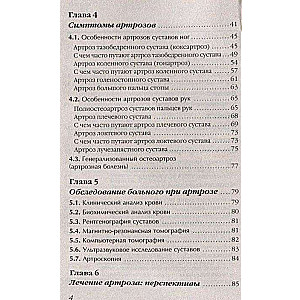 Artroze. Atbrīvojamies no sāpēm locītavās