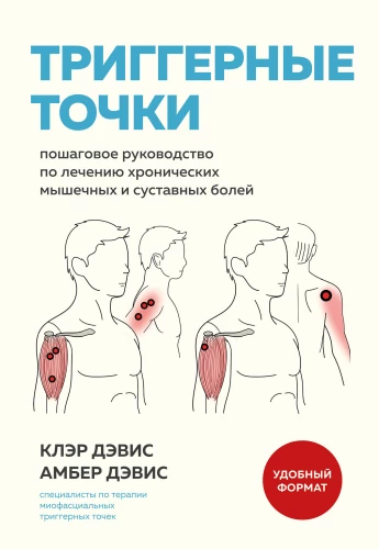 Trigerpunkti. Soli pa solim rokasgrāmata hronisku muskuļu un locītavu sāpju ārstēšanai