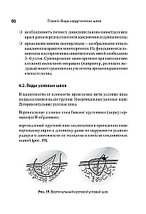 Ķirurģiskais šuvums