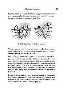 Ķirurģiskais šuvums