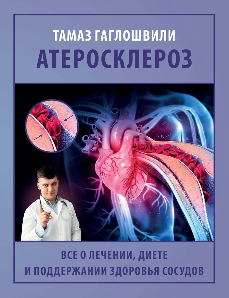 Ateroskleroze. Viss par ārstēšanu, diētu un asinsvadu veselības uzturēšanu