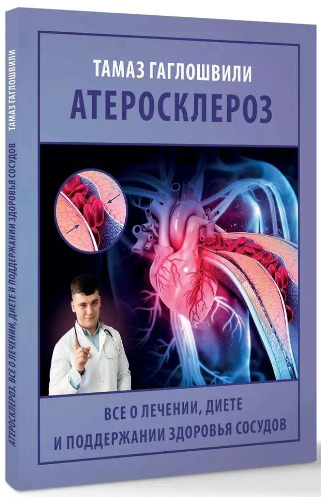 Ateroskleroze. Viss par ārstēšanu, diētu un asinsvadu veselības uzturēšanu