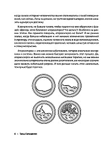 Ateroskleroze. Viss par ārstēšanu, diētu un asinsvadu veselības uzturēšanu